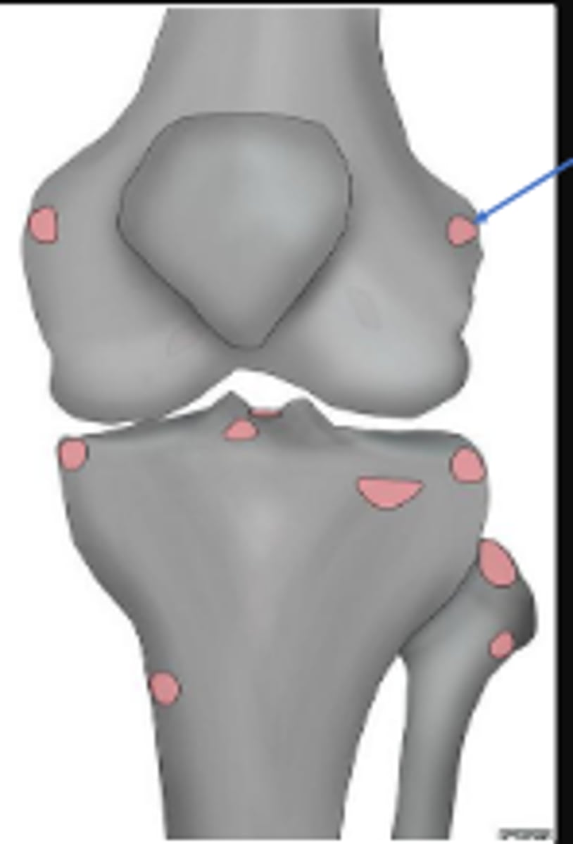 <p>What is the most significant radiographic finding?</p>