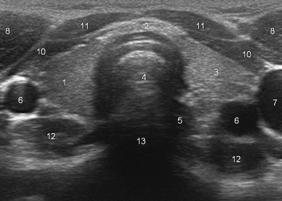 <p>What does “12” represent?</p>