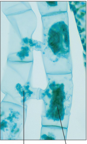 <p>What part of the Spirogyra is the right line pointing to?</p>