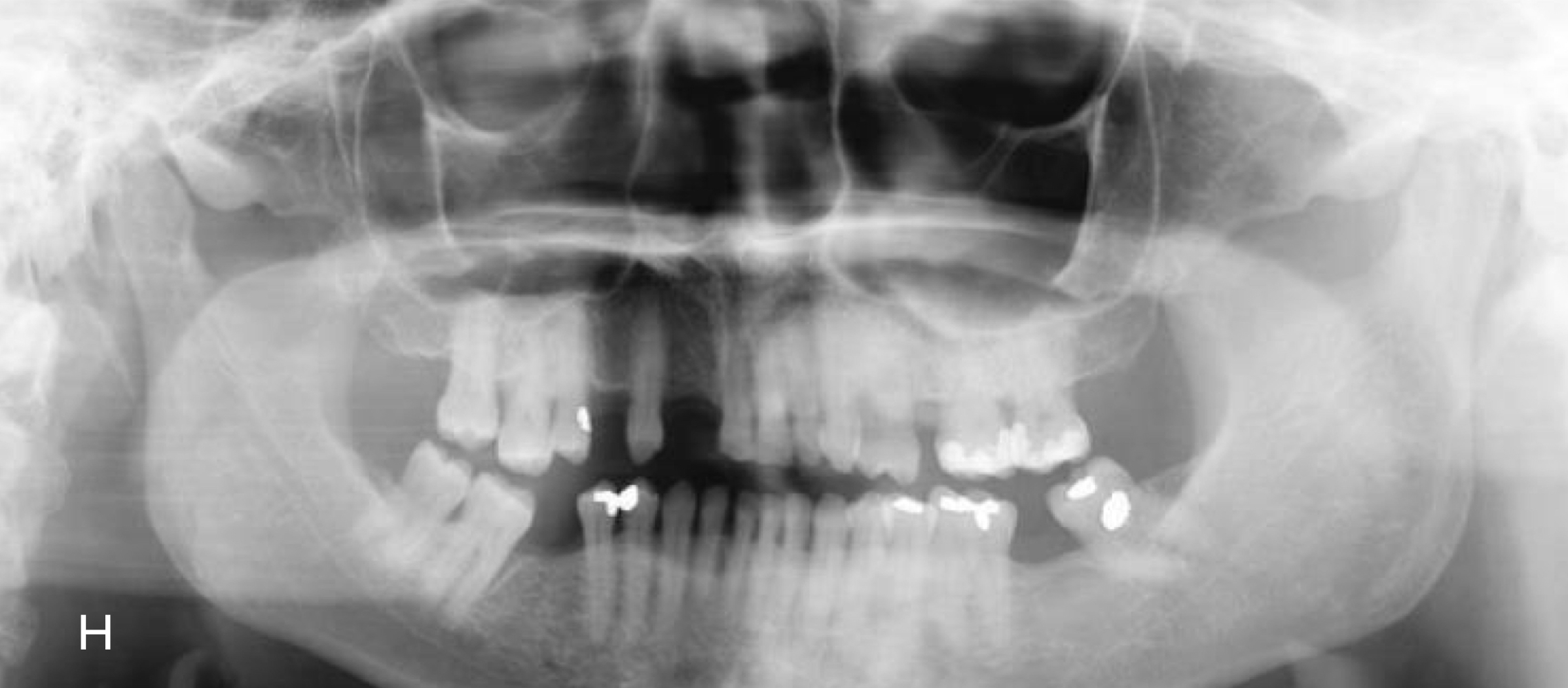 Lengthening of image
