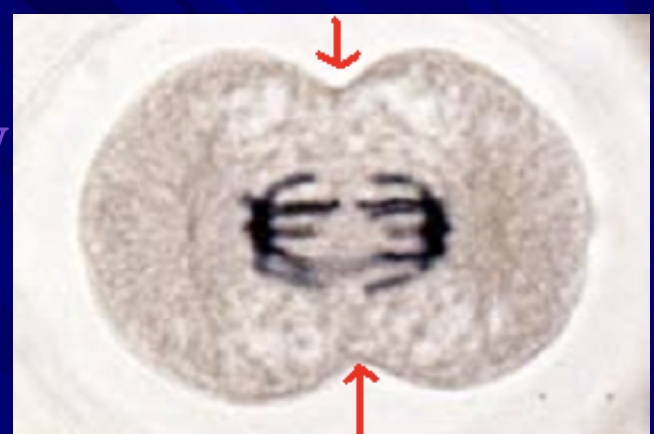 <p>what are the arrows pointing to&nbsp;</p>