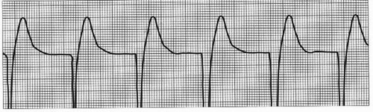 <p>recurring motion, rhythm</p>