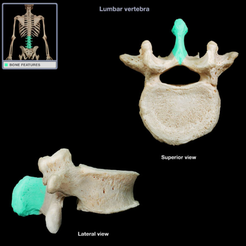 <p>Location: Vertebrae (posterior aspect)</p><p>Description: Unpaired, posterior projection from midline of vertebral arch, Has characteristic thick, blunt form</p>