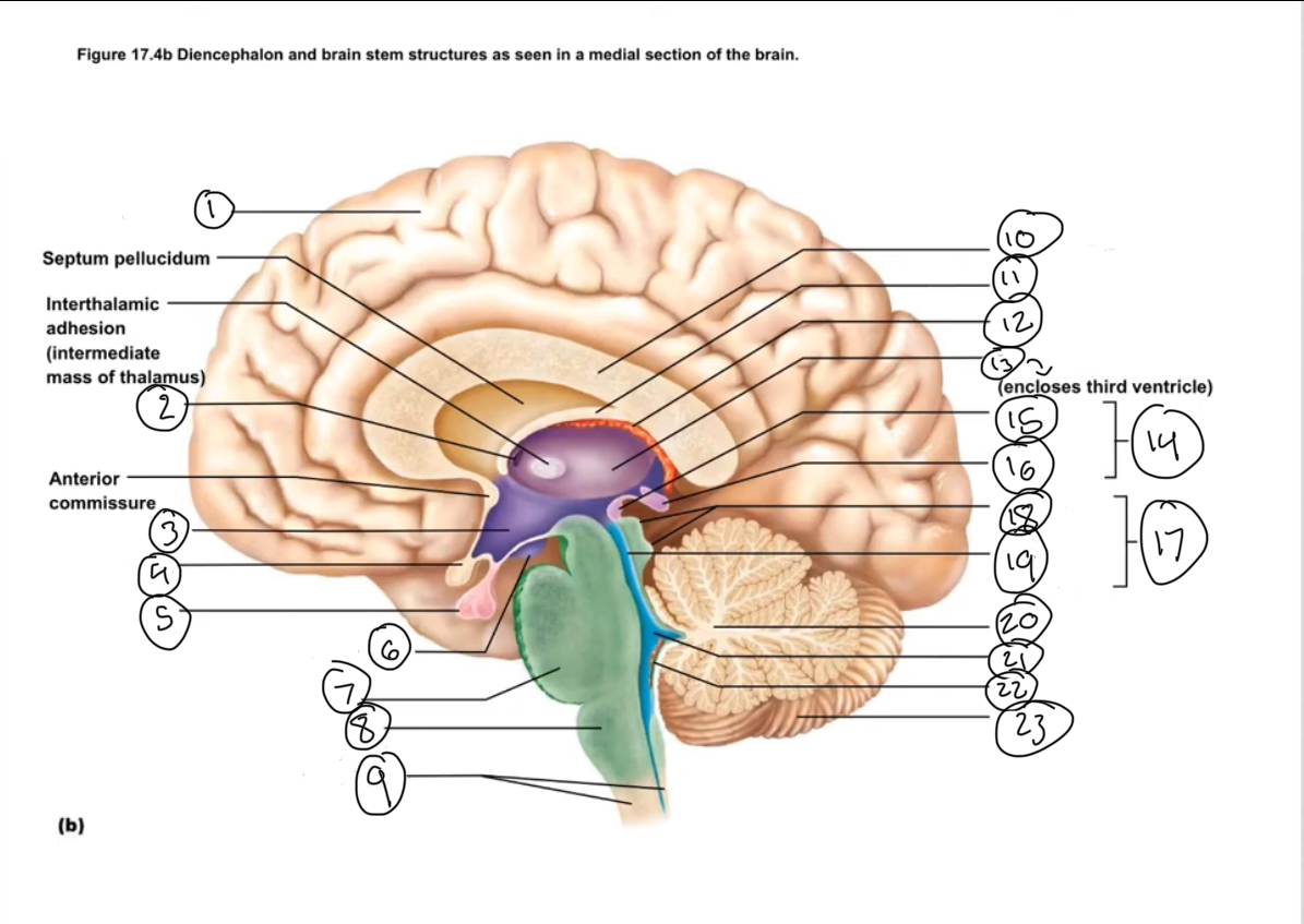 <p>Name 16</p>
