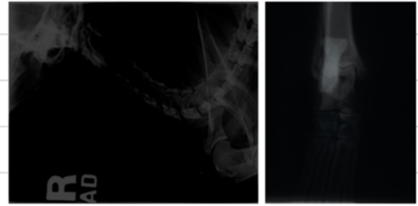 <p>a dark film, because of overexposure. when we increase the kV, the xrays have so much energy that even when interacting with atoms, they will still pass through/</p>