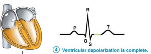 Ventricular depolarization is complete.
