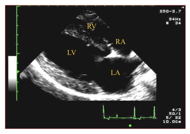 <p>Types of views - RPS view which chamber is clostest to probe </p>