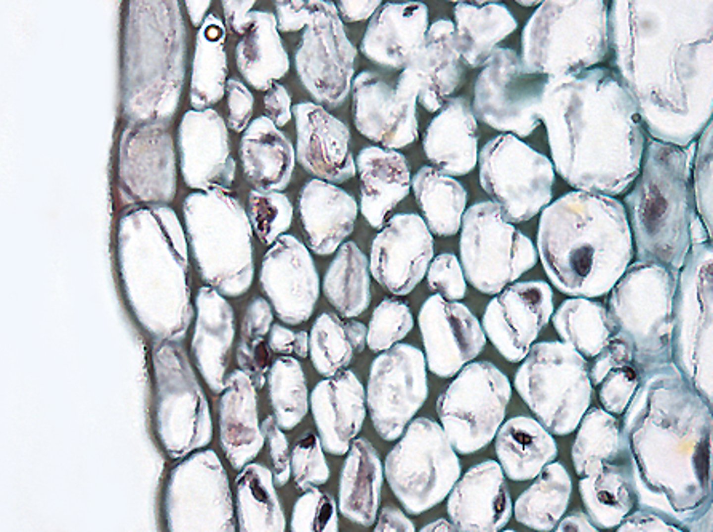 <p>collenchyma</p>