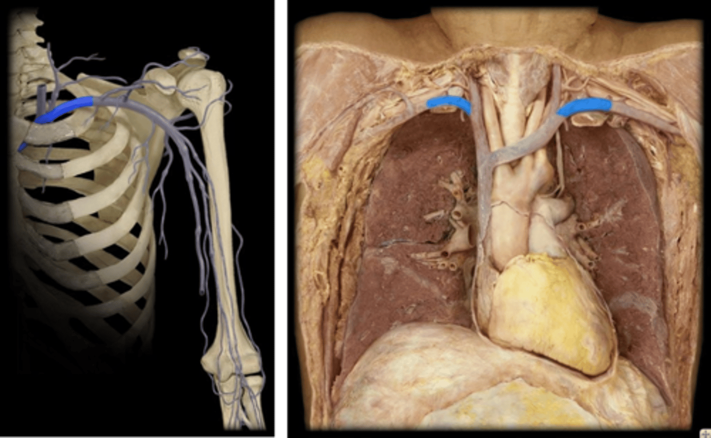 <p>Name these vessels.</p>