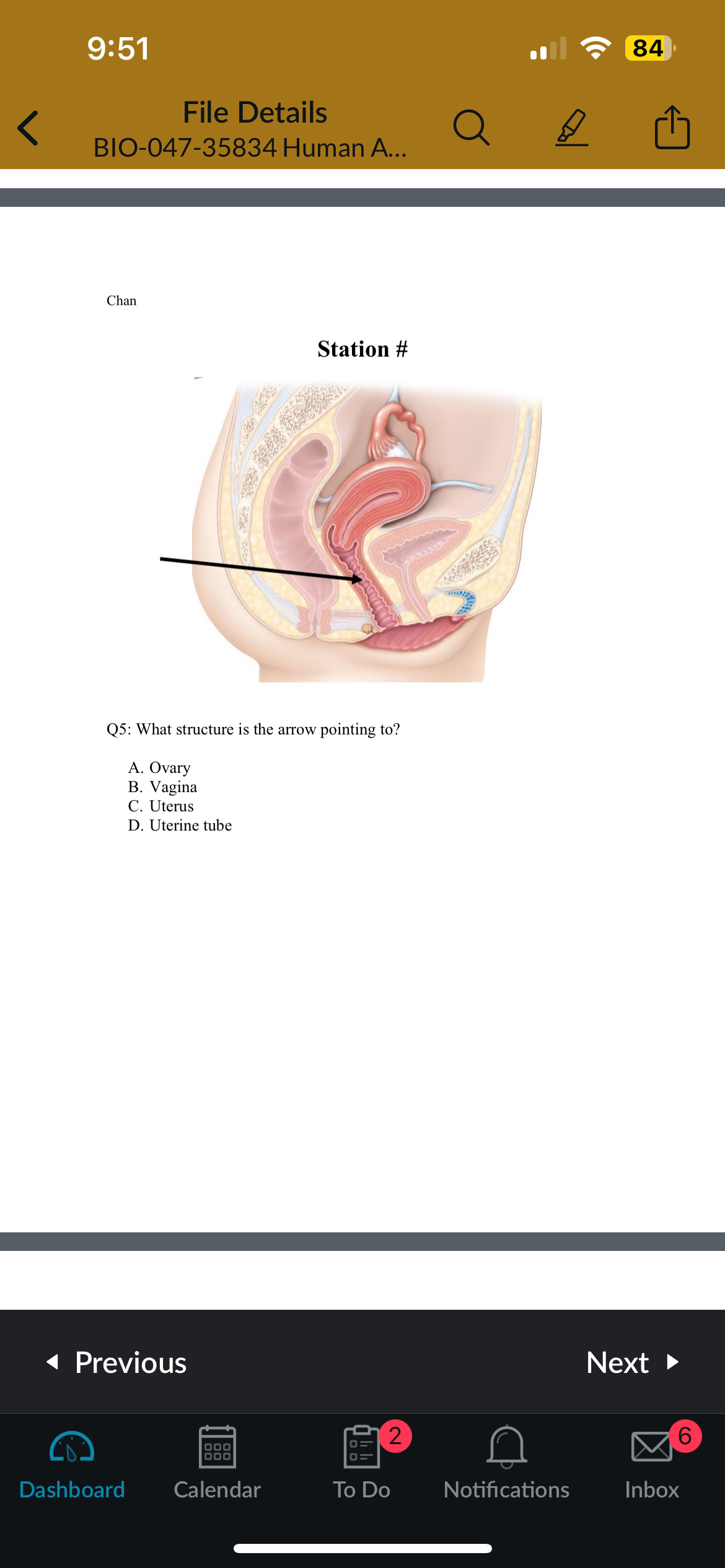 <p>Q5: What structure is the arrow pointing to</p>