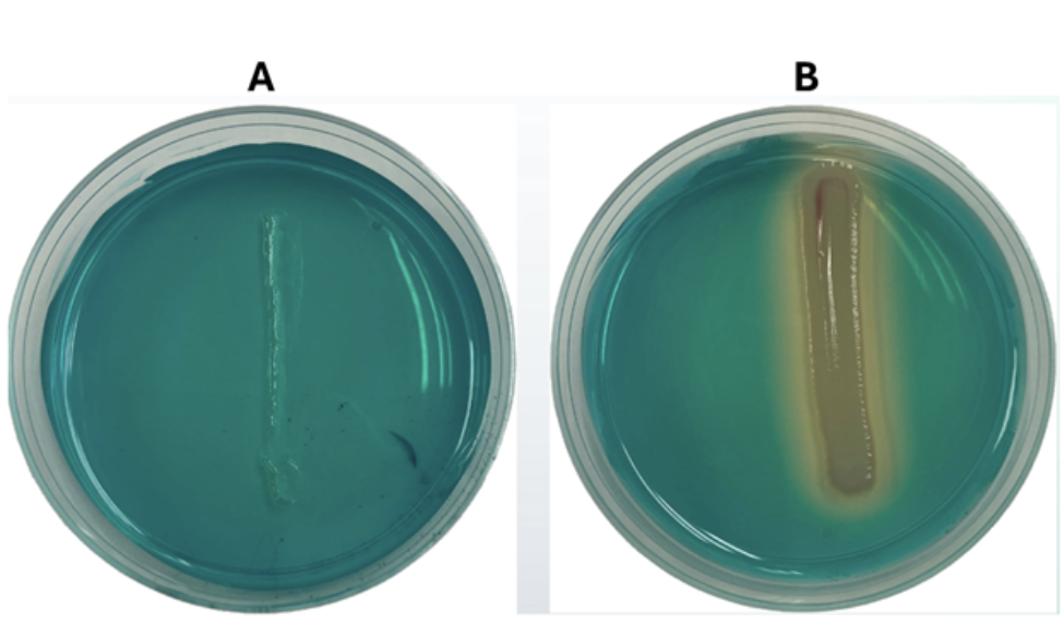 <p>These are the results of two samples inoculated on DNase agar. What can you conclude about sample A?</p><ul><li><p>sample A is negative for DNase</p></li><li><p>sample A is Gram-positive</p></li><li><p>sample A is Gram-negative</p></li><li><p>sample A is positive for DNase</p></li></ul><p></p>