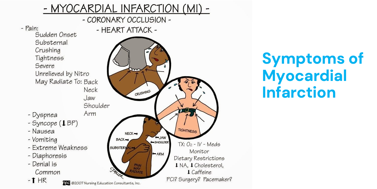 <ul><li><p>Myocardial infarction - tissue death of the cardiac muscle due to blockage of blood vessels of the heart</p></li><li><p>No oxygen = no contraction = no CO</p></li><li><p>Diaphoresis = sweating</p></li></ul><p></p>