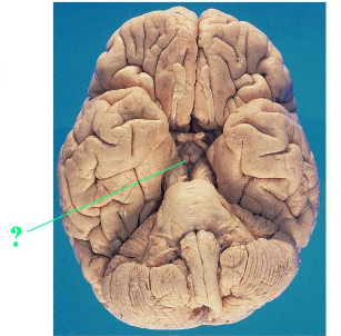 <p><span>Identify the indicated structure of the brain.</span></p>