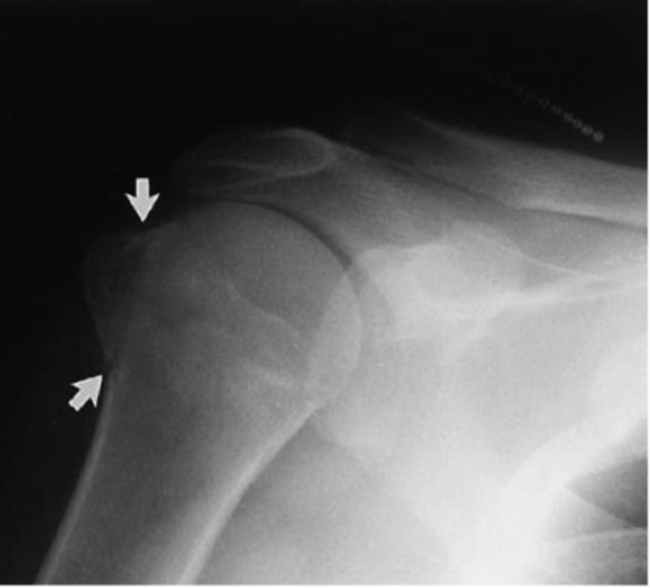 <p>What is the issue?</p>