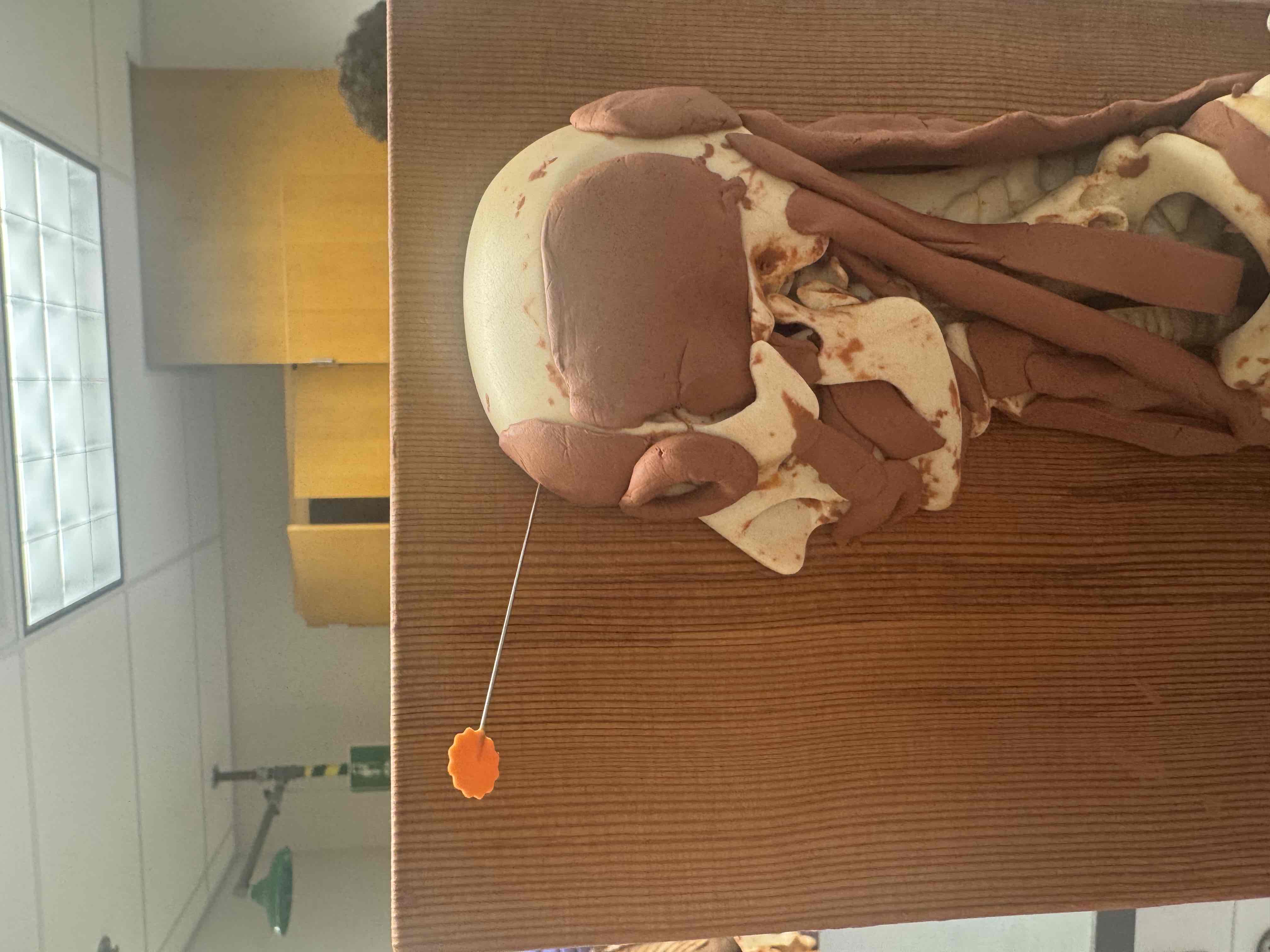 <p>origin frontal bone, insertion epicranial aponeurosis, action wrinkles forehead &amp; raises eyebrows</p>
