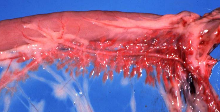<p>Tissues from a 6-month-old dog. Histologic examination reveals small pancreatic lobules that are infiltrated by moderate numbers of lymphocytes. Acinar structures are reduced in number, and acinar cells lack zymogen granules. Scattered cells contain lipofuscin. Name of condition? Predisposed breed of dog?</p>