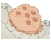 <p>Osteoclasts</p>