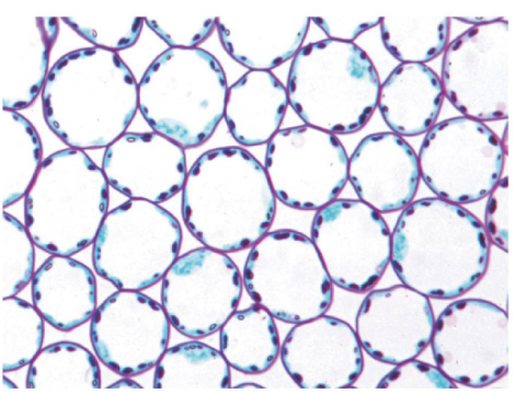 <p>Thin and flexible cell walls containing large central vacuoles that function to store organic products, photosynthesize, and perform cellular respiration </p>