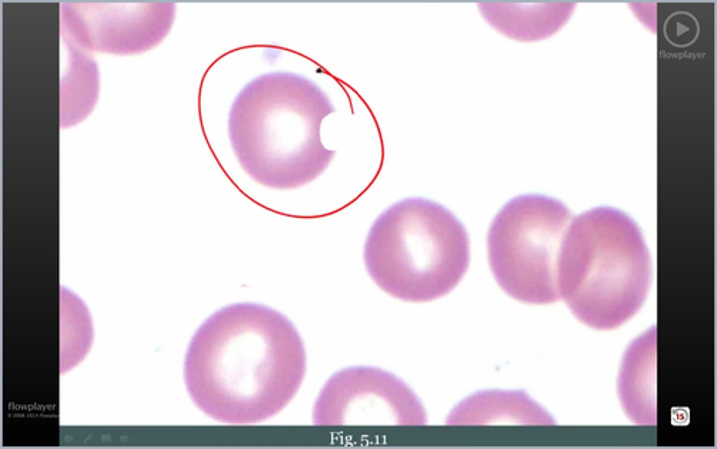 <p>wtf rbc4? cause?</p>