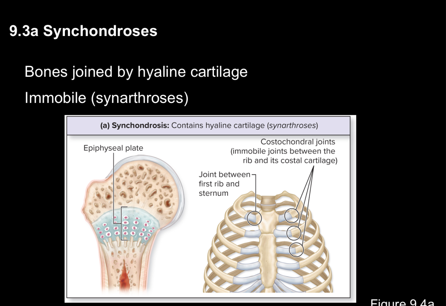 <p>Bones joined by hyaline cartilage</p>