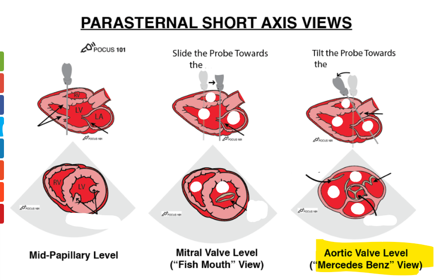 <p>label structures </p>
