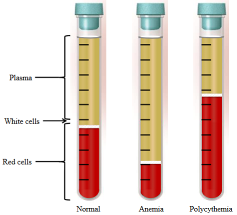 <ul><li><p>Where the value of the hematocrit is significantly higher than the normal range. </p><ul><li><p>A value of &gt; 48% in women and &gt; 52% in men is a sign of polycythemia. </p></li></ul></li><li><p>Sometimes seen as an adaptation in mountain/high altitude dwellers who are frequently exposed to low O₂ levels, leading to increased RBC levels. </p></li><li><p>Sometimes seen in athletes that use erythropoietin (EPO) to artificially raise their RBC count to increase efficiency of performance.  </p></li></ul><p></p>