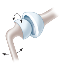 <p>What type of joint is this? </p>