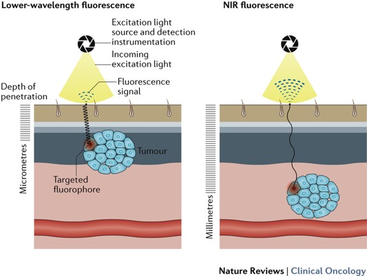 <ul><li><p>Biocompatible</p></li><li><p>Excellent ROS generation ability</p></li><li><p>Strong near-infrared (NIR) absorption</p></li><li><p>NIR = longer WL = will pass through skin to tumour</p></li></ul><p></p>