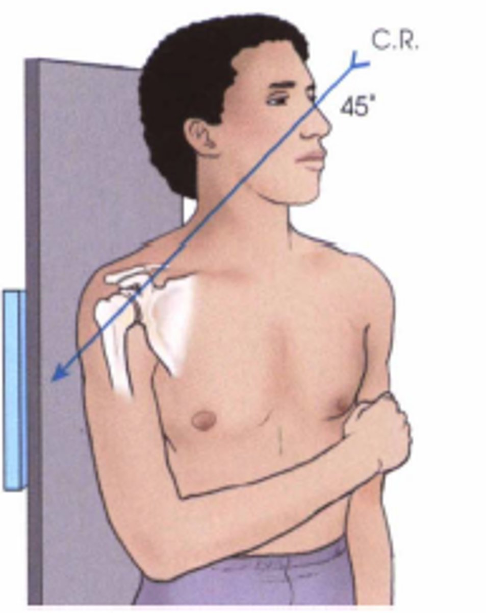<p>used to see glenoid fractures, Hill-Sachs, and humeral dislocations, posterior oblique, CR 45° caudal to scapulohumeral joint</p>