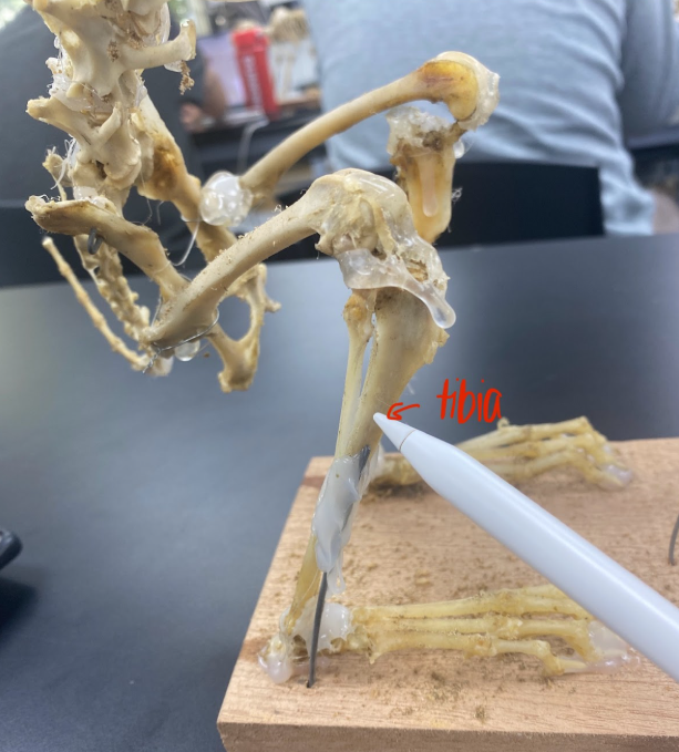 <p>Tibia</p>