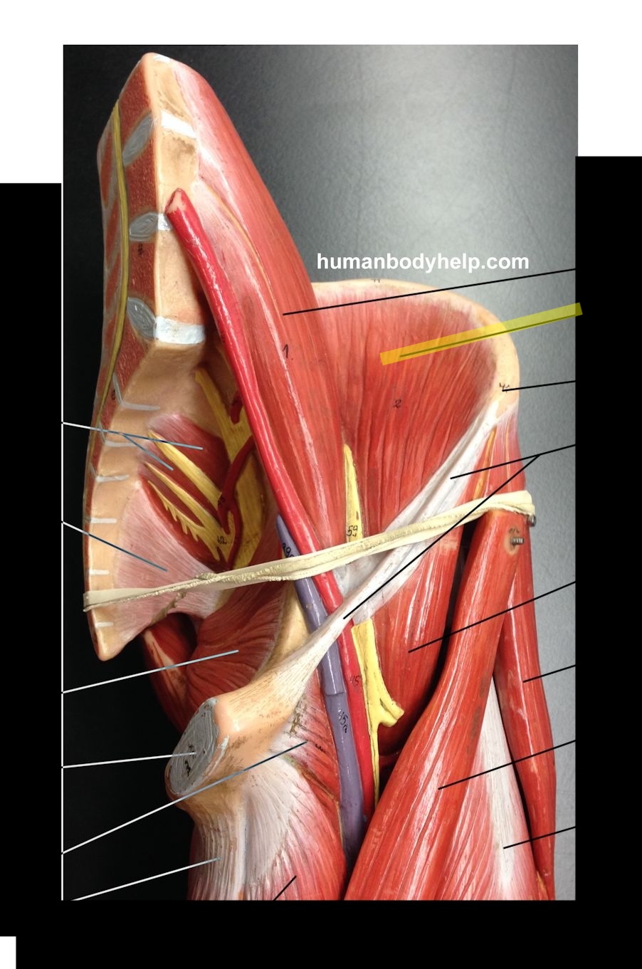 <p>What muscle is this? </p>
