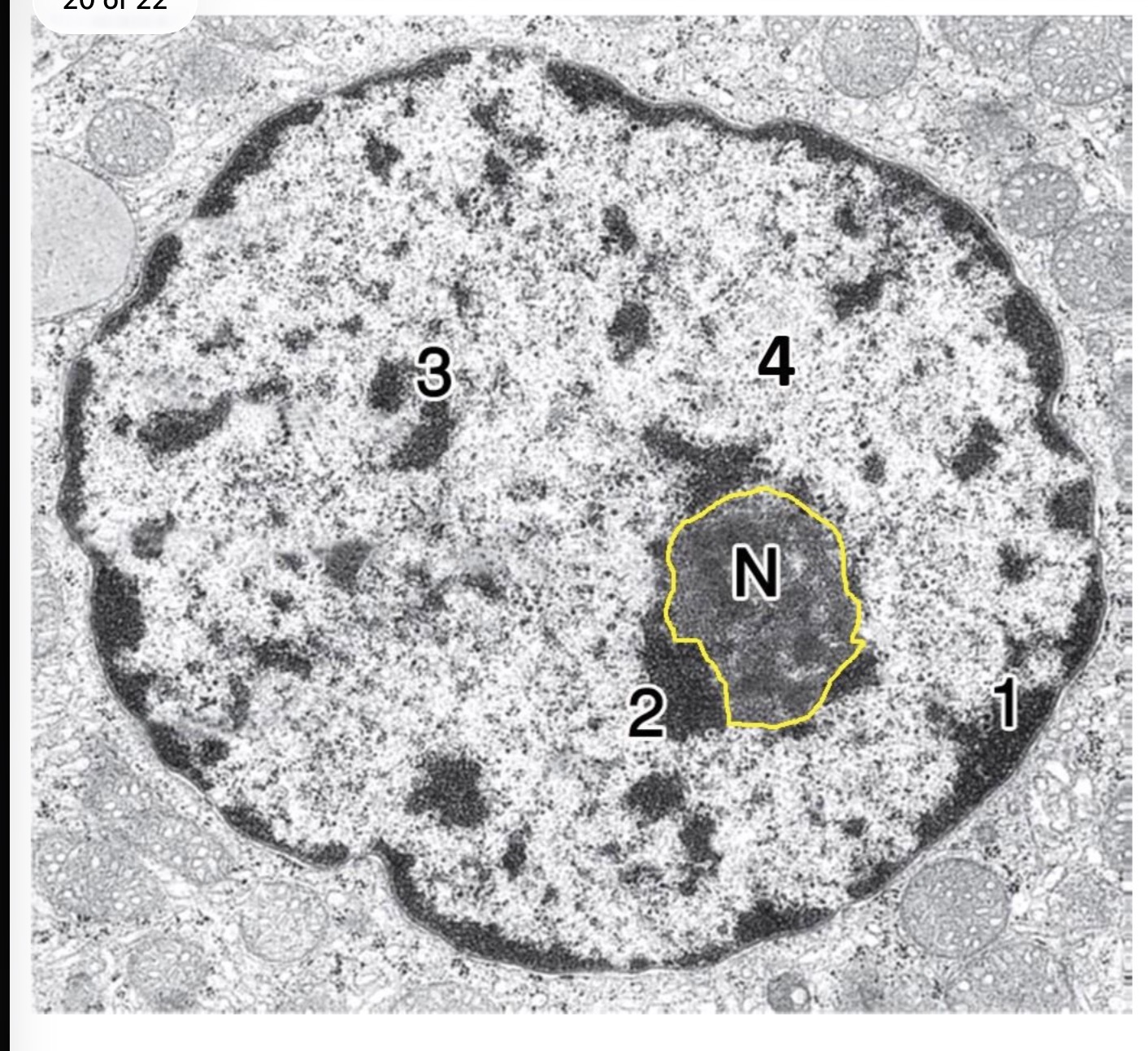 <p>Answer the questions in these following pictures</p>