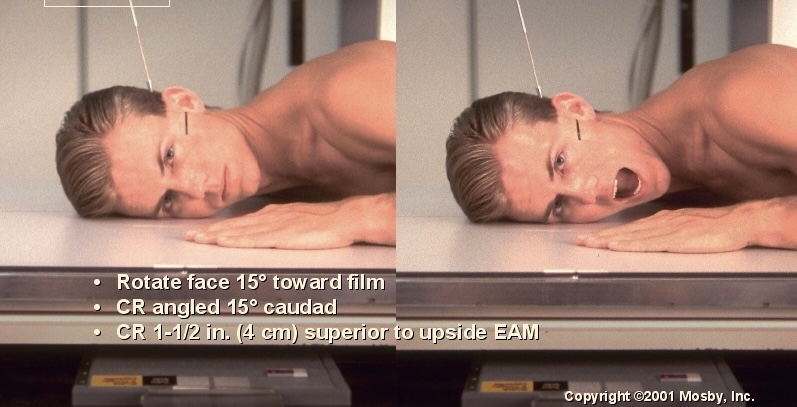 <p>What position is this?</p>