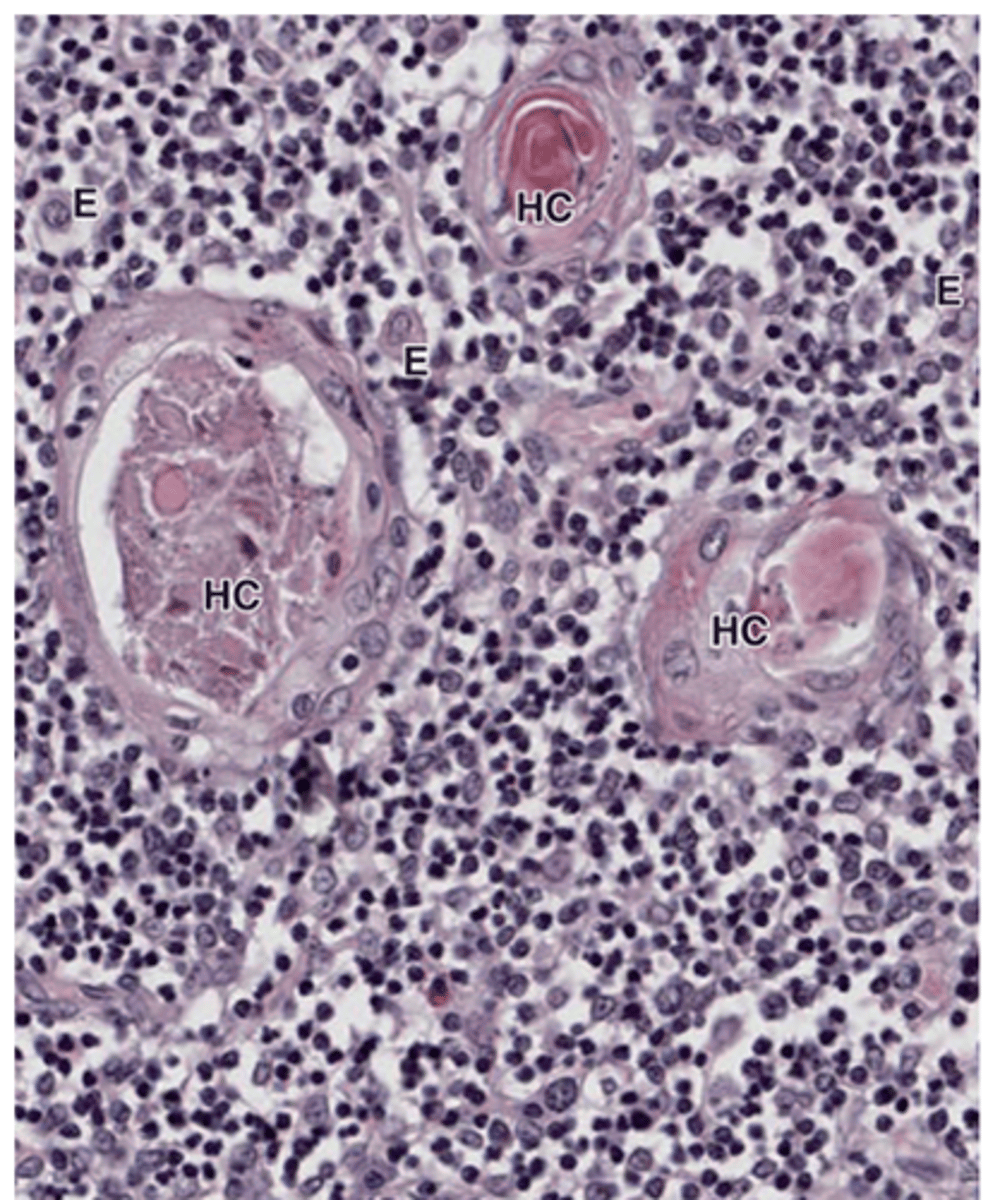 <p>What process occurs at the center of Hassall’s corpuscles?</p>