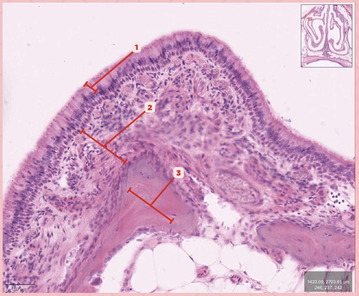 <p>Identify the structure labeled as 3.</p>