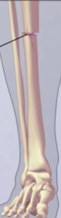 <p><span>What type of skin Penetration is this?</span></p>