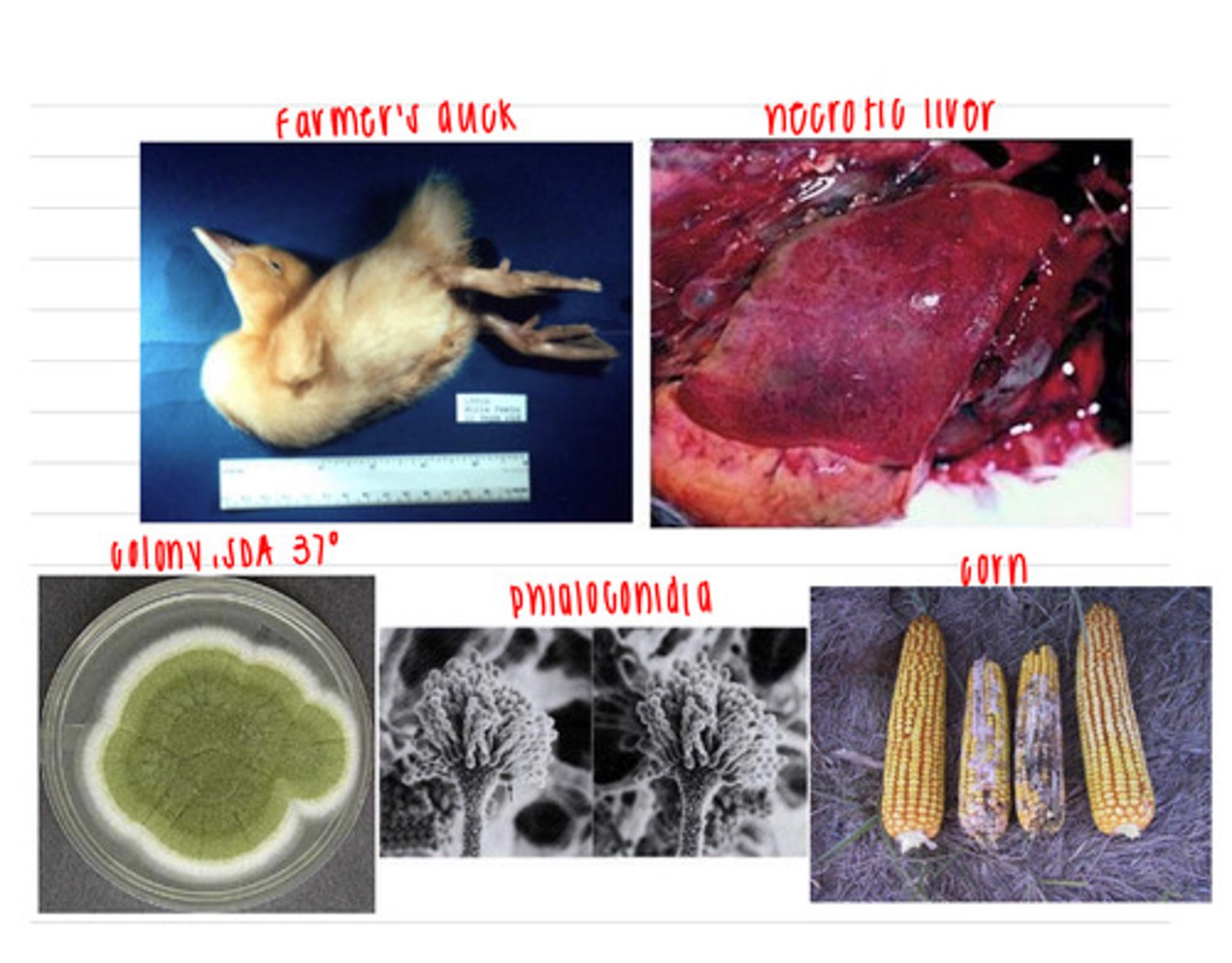 <p>a farmer brings in a duckling on his farm that he noticed was experiencing ataxia, opisthotonos (muscle spasms), and then suddenly died. the vet does a necropsy and observes aplasia of the thymic cortex and necrosis of the liver. the farmer says that the corn that the animals have been eating does look a little moldy, so he brings in one for examination. the vet isolates some cells from the corn on SDA at 37 degrees and observes the colony and the phialoconidia that has grown. what is the diagnosis (disease+fungal species+mycotoxin)?</p>