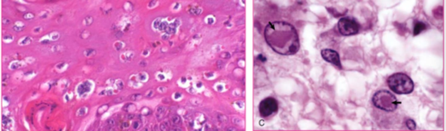 <p>which viral inclusions?</p>