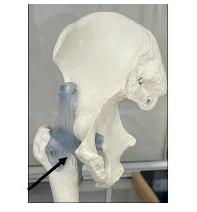 <p>Identify the joints in this picture and classify them</p>