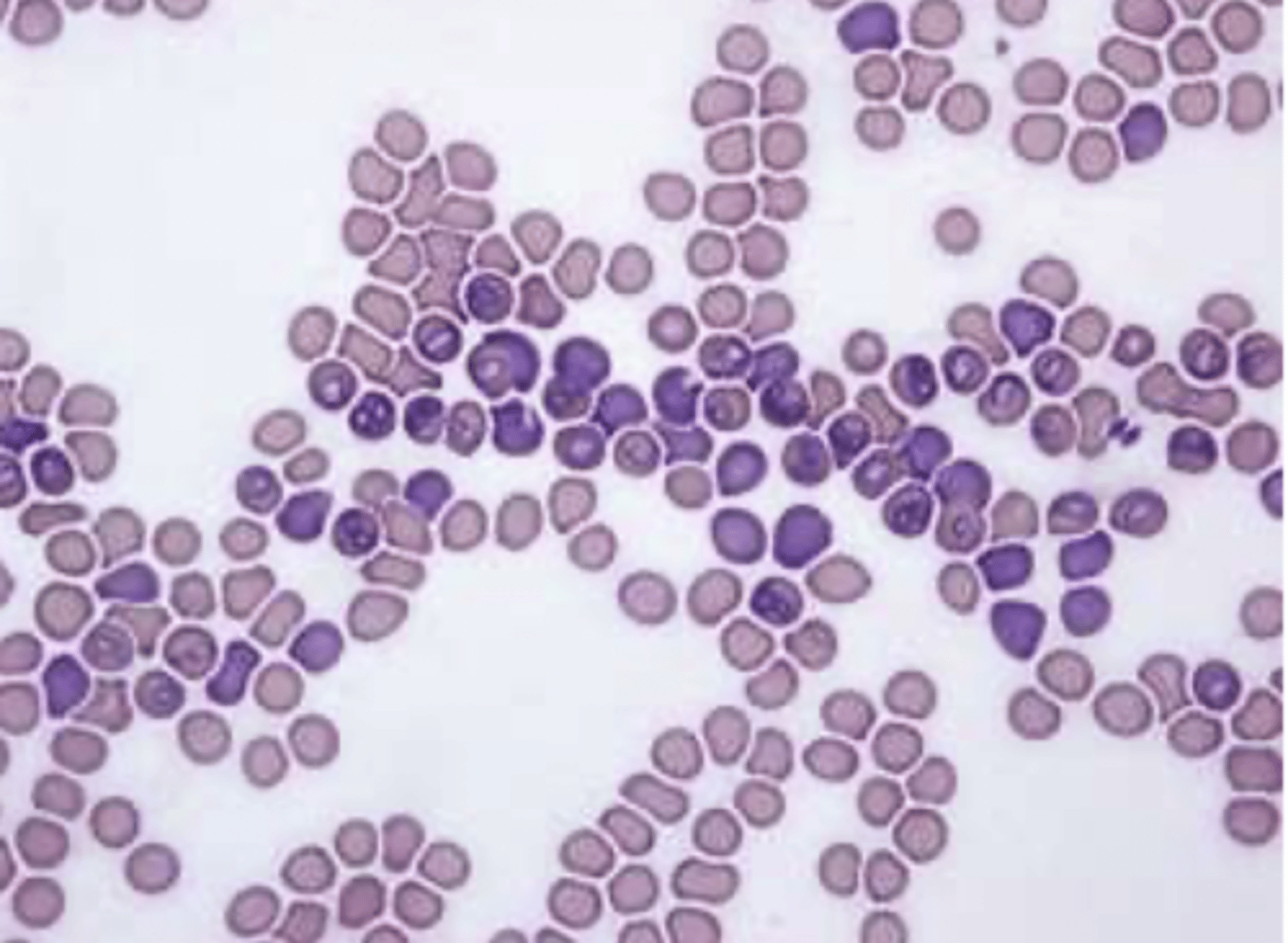 <p>interpretar esta muestra de sangre:</p>