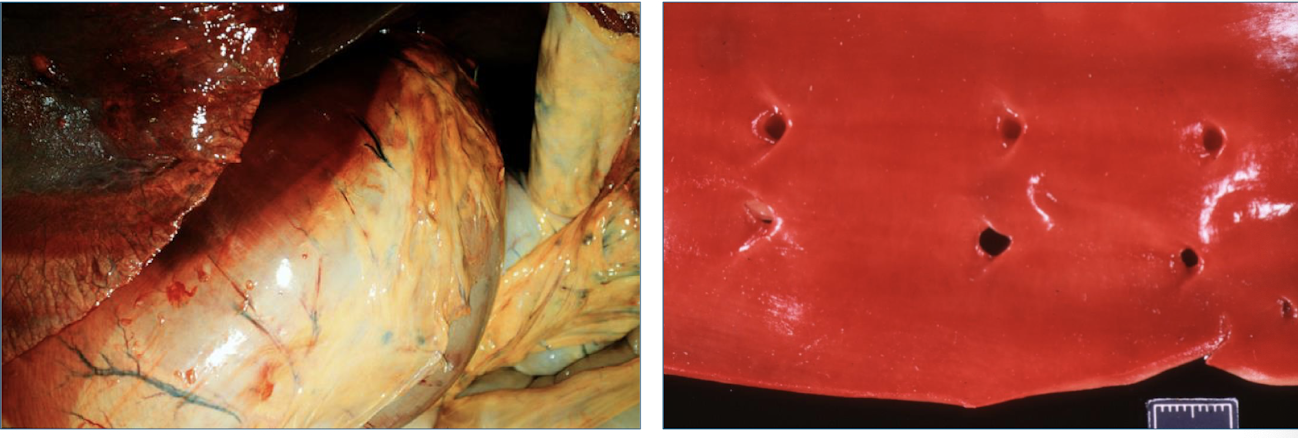 <p>intima & endocardium, surrounding tissues</p>