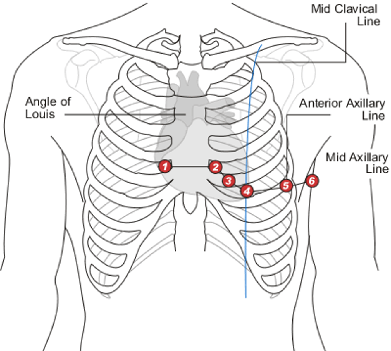 <p>V5: anterior axillar line, at the level of V4</p><p>V6: midaxillary line, at the level of V4</p><p>Together, give us a view of the left side of the heart</p>