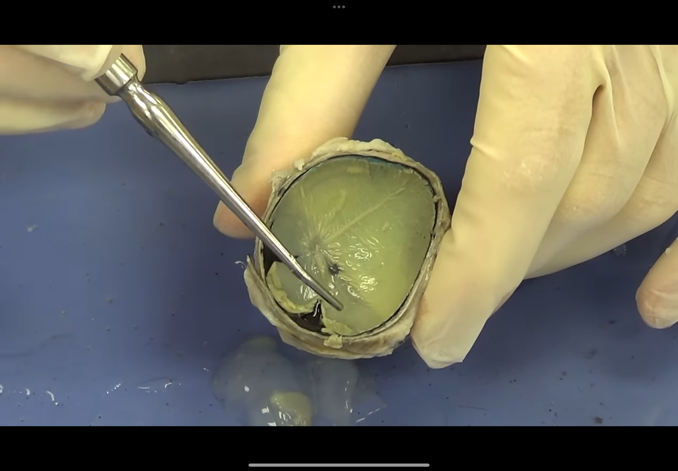 <p>Green looking area</p>