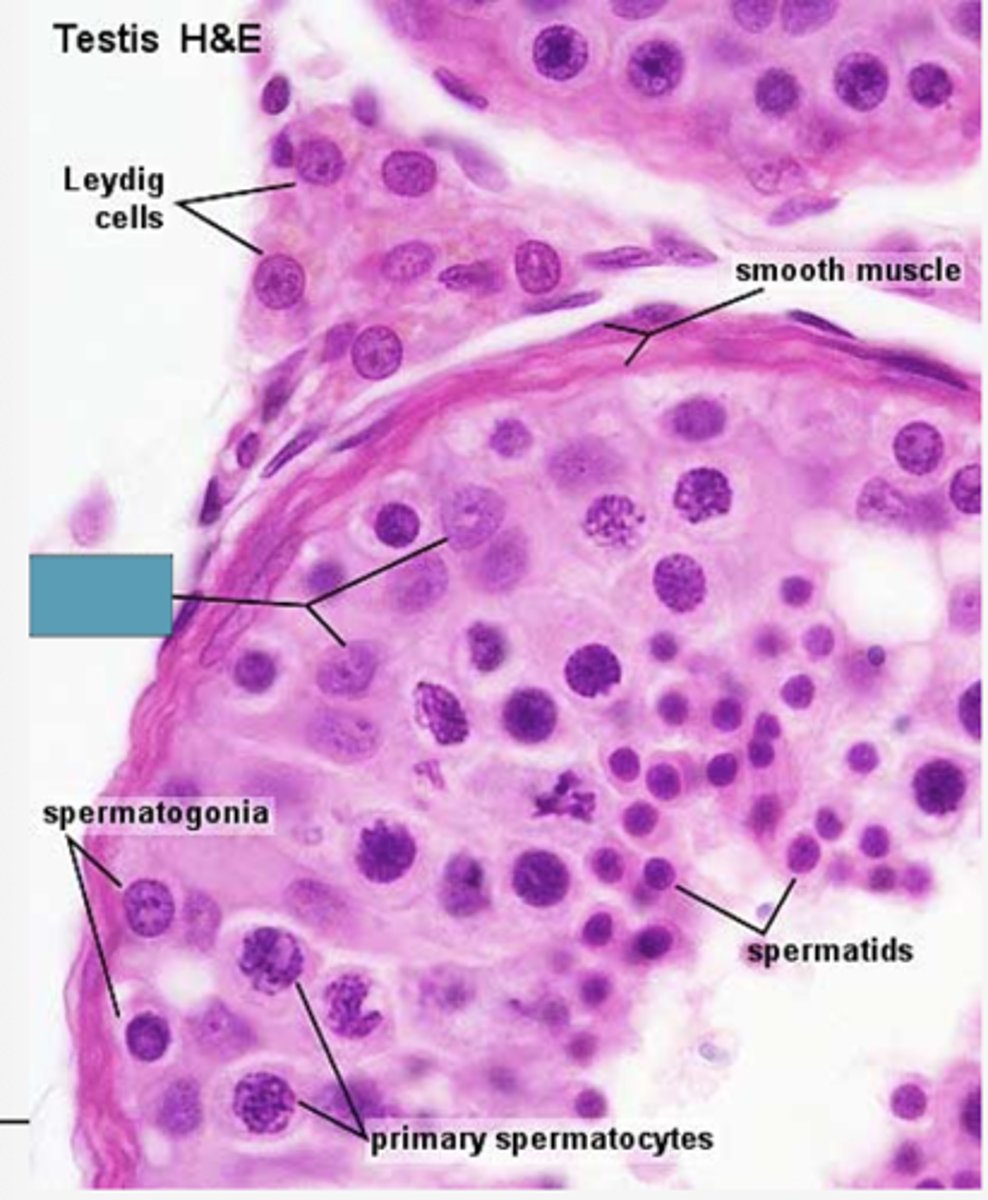 <p>Identify the cells</p>