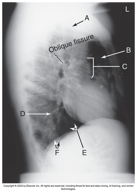 <p>What anatomical structure is letter D?</p>