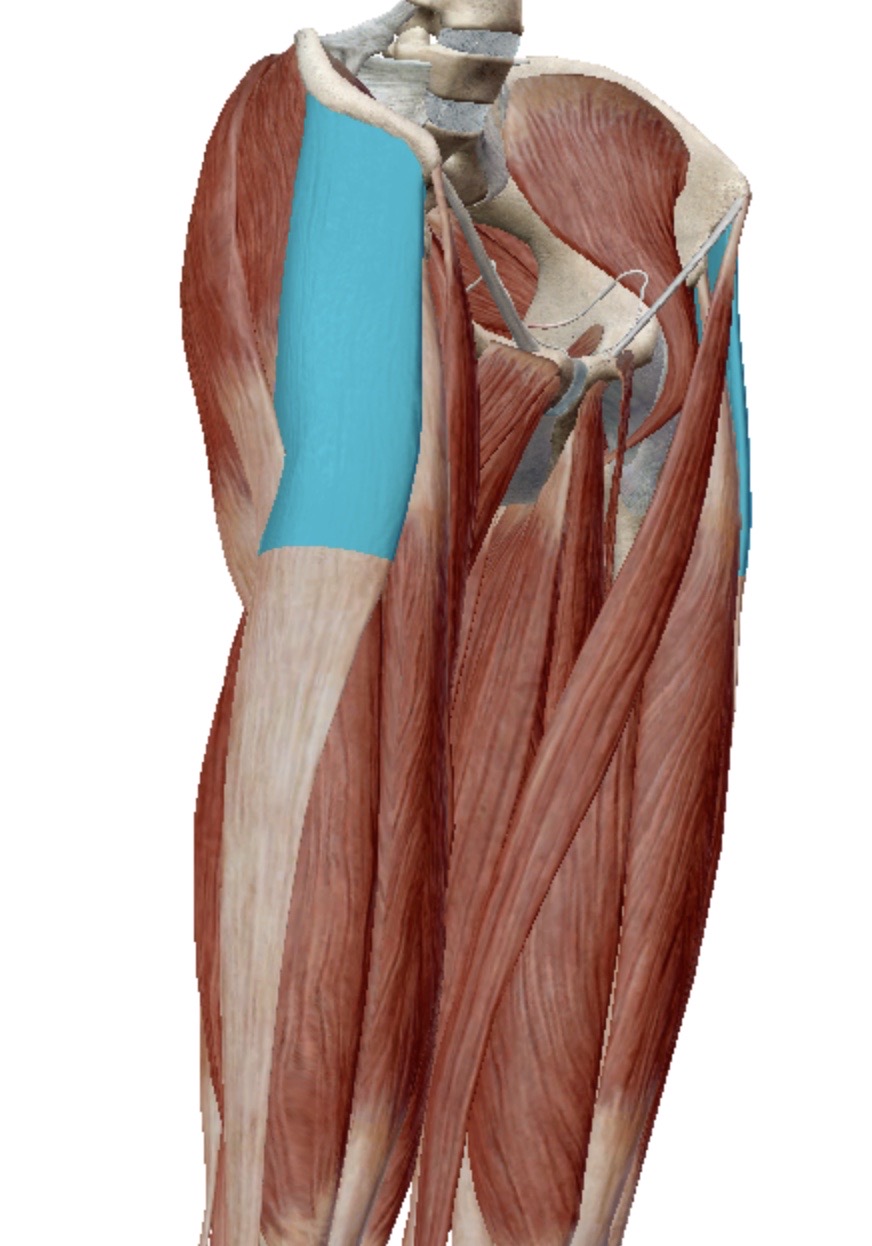 <p>Identify this muscle</p>