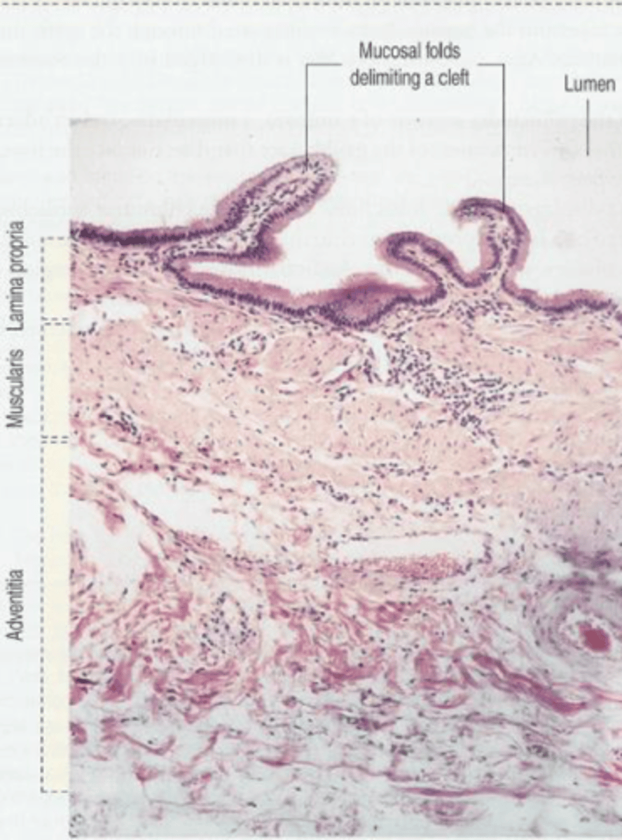 <p>Consists of epithelium, connective tissue, and smooth muscle.</p>