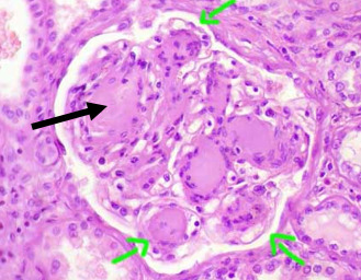 tiny capillary tufts surrounded by glomerular capsule in the renal cortex part of the nephron that filters blood
