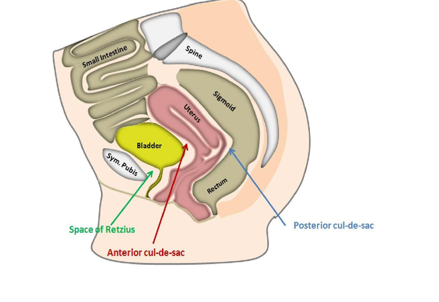 <p>The space of retzius is located between the ___ and ___</p>
