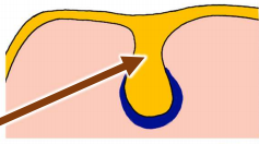 <p>Quais as componentes <mark data-color="yellow" style="background-color: yellow; color: inherit">ectodérmicas </mark>e <mark data-color="blue" style="background-color: blue; color: inherit">mesenquimatosas </mark>dos dentes? Por que células são compostas?</p>